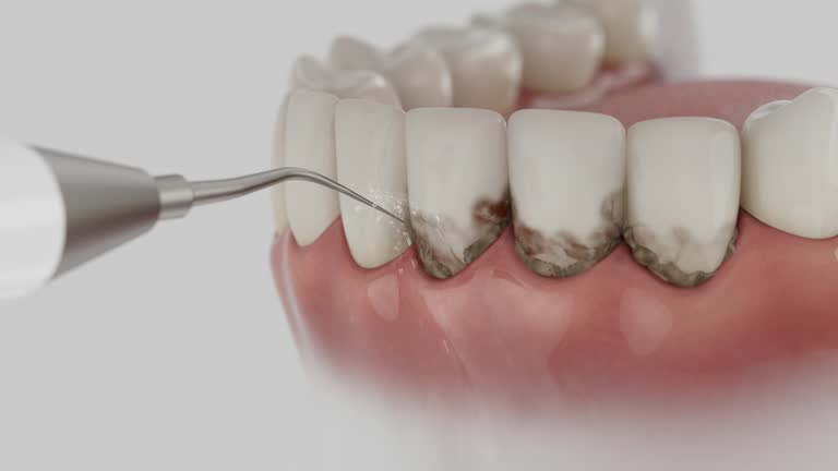 Reliable Teeth Cleaning And Checkup contractor in Oscoda County County, MI by Dentist Open Now